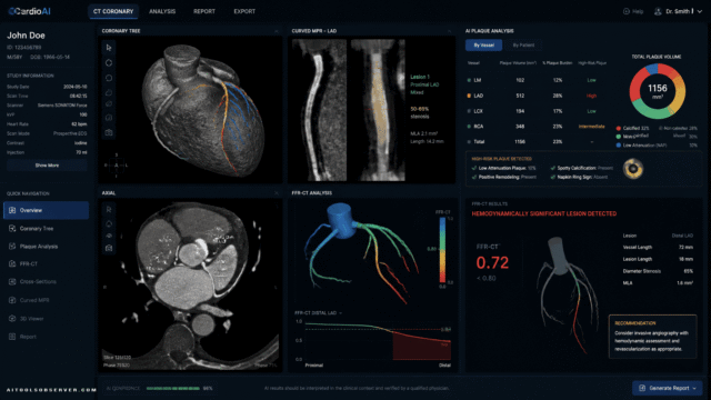 FDA Clears Keya Medical’s Deep Vessel Plaque: AI CCTA Plaque Quantification and FFR-CT From a Single Scan