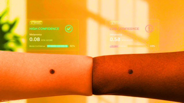 AI Dermatology Bias: Why Skin Cancer Detection Tools Fail on Darker Skin